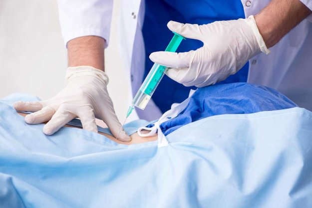 anesthesia for spine surgery doctor giving anesthesia for spine surgery